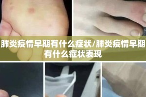 肺炎疫情早期有什么症状/肺炎疫情早期有什么症状表现