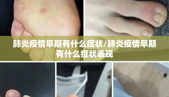 肺炎疫情早期有什么症状/肺炎疫情早期有什么症状表现