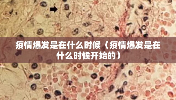 疫情爆发是在什么时候（疫情爆发是在什么时候开始的）